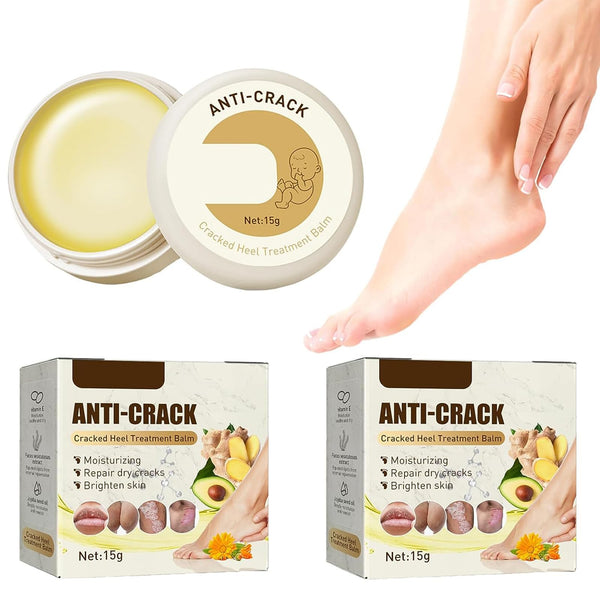 Krema za Ispucale Pete (1+1 GRATIS)