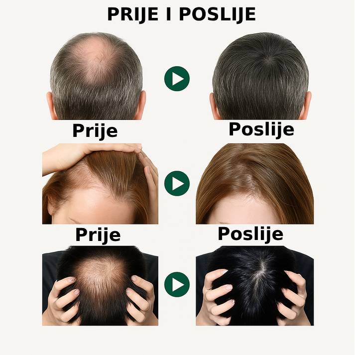 Serum za rast i gustoću kose 1+1 Gratis