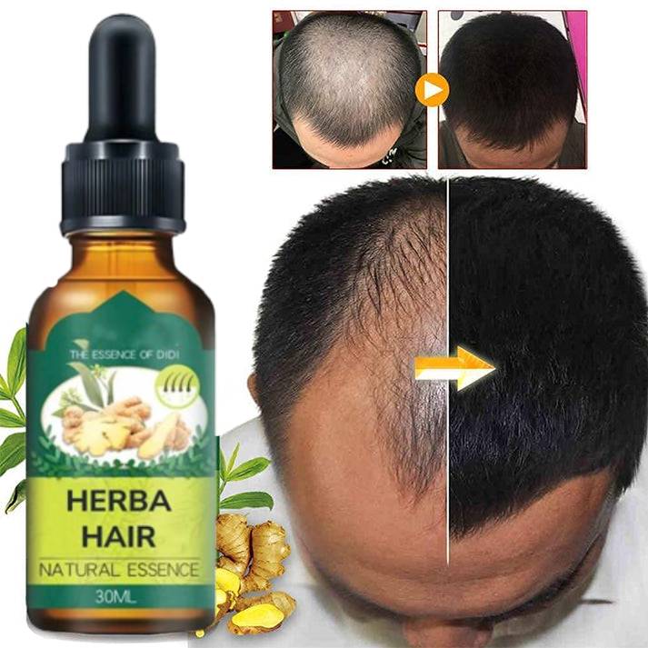 Serum za rast i gustoću kose 1+1 Gratis