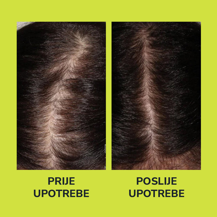 Serum za rast i gustoću kose 1+1 Gratis
